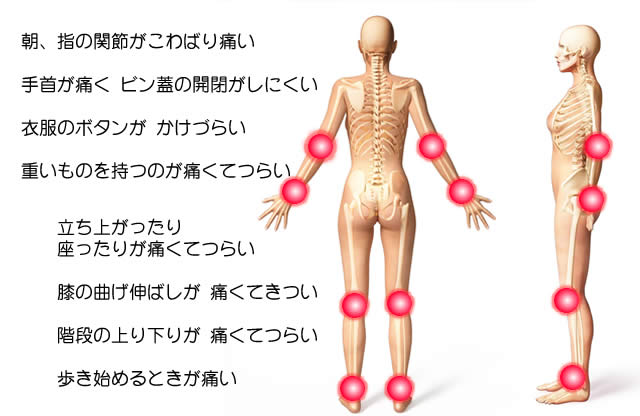 関節リウマチ痛みの部位：足、膝、肘、手首、指